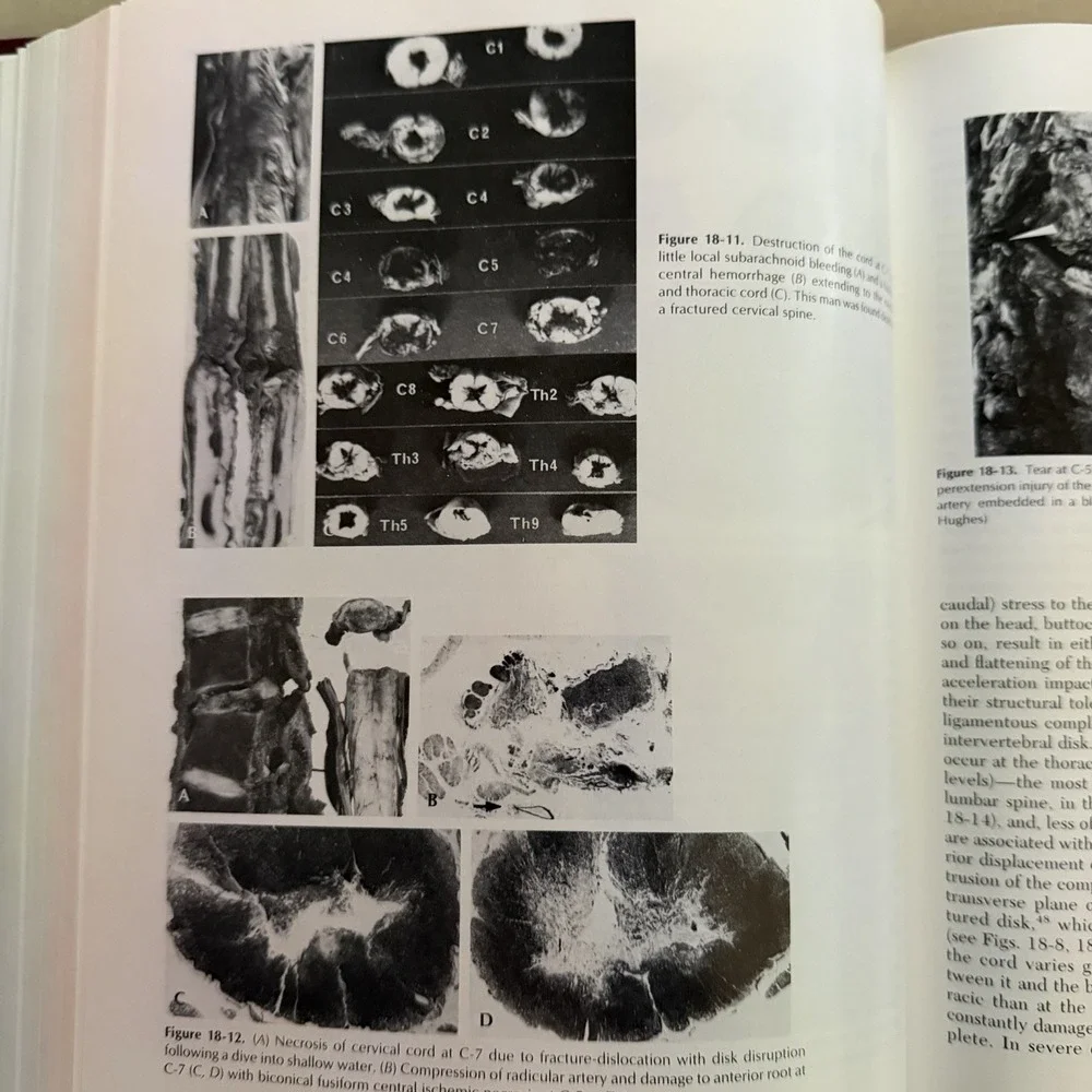 SPINAL TRAUMA By Thomas J. Errico & R. David Bauer - Hardcover